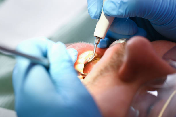 Best Emergency TMJ Treatment in Point Clear, AL