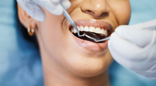 Best Emergency Wisdom Teeth Removal in Point Clear, AL